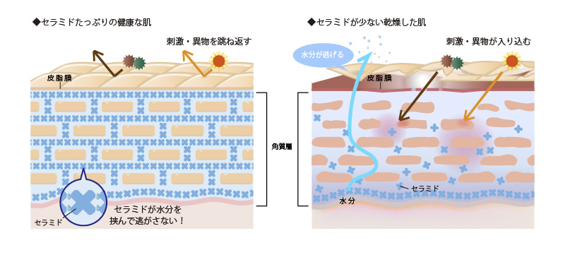 セラミドたっぷりの肌とそうでない肌